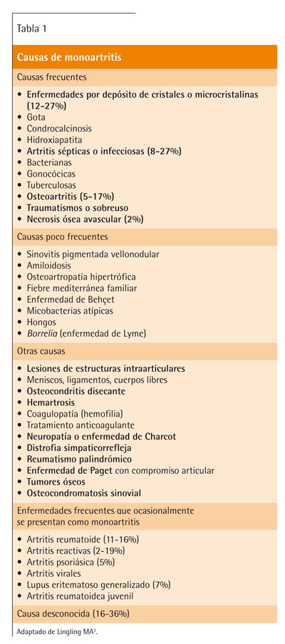 Reumatismul articular acut (RAA) | Bioclinica